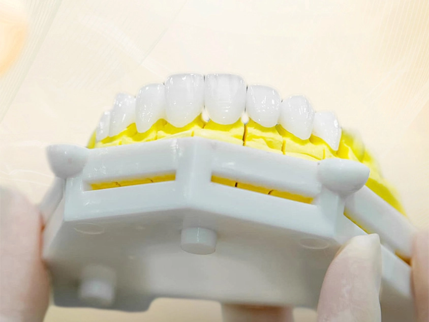 Răng sứ Zirconia được chế tác hoàn toàn từ vật liệu Zirconium Dioxide (ZrO2)